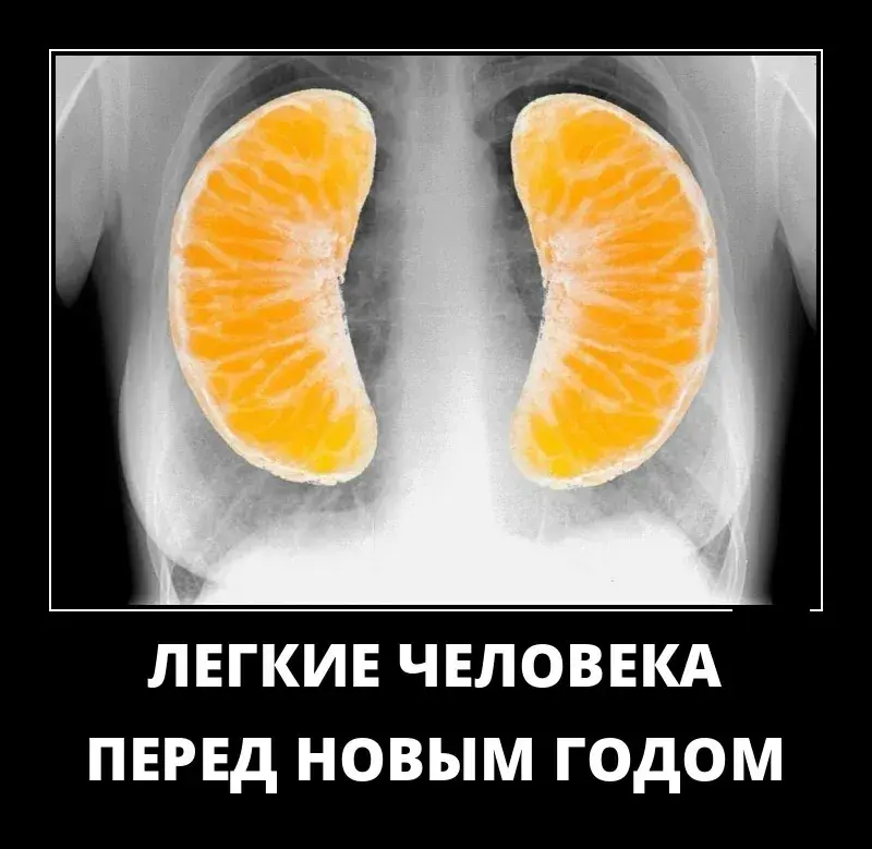 Открытка Демотиваторы - Рентген грудной клетки: шуточная новогодняя открытка | Красивая открытка #11